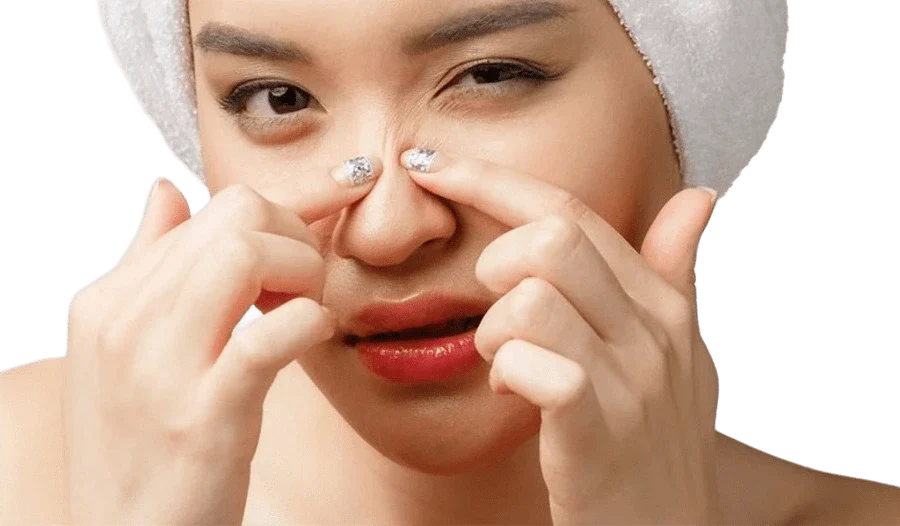 O Guia Completo para Remover Cravos: Removedor Lanbena vs Máscaras e Adesivos!